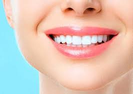 Cosmetic Smile Transformation